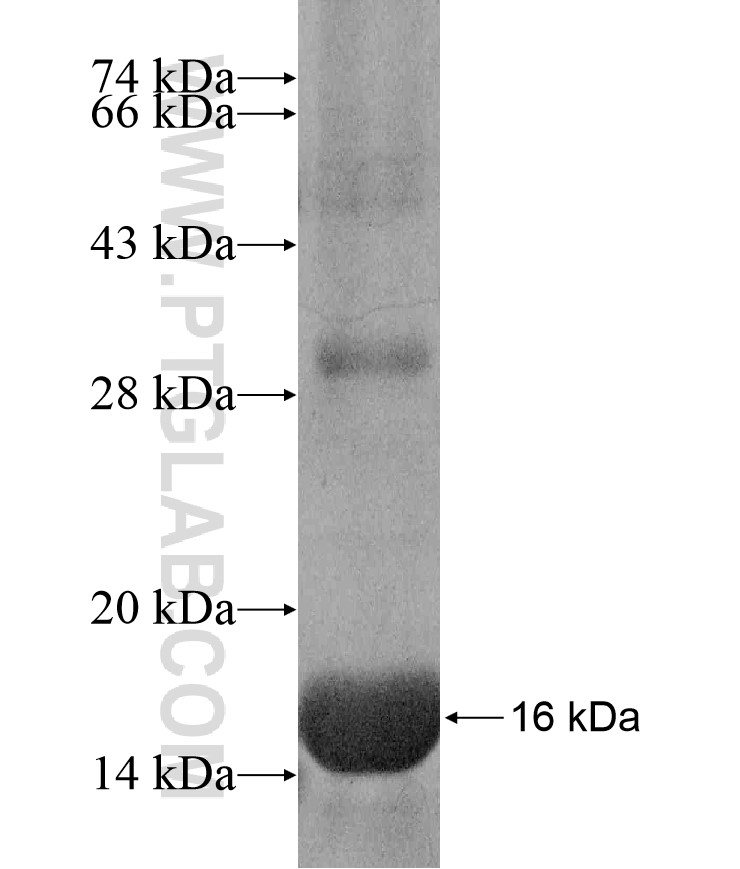 RASSF3 fusion protein Ag17184 SDS-PAGE RASSF3 fusion protein Ag17184 SDS-PAGE