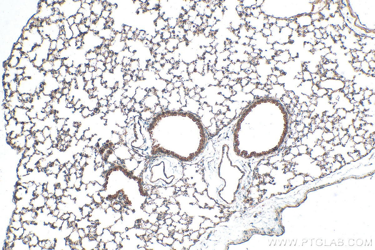 IHC staining of mouse lung using 19118-1-AP
