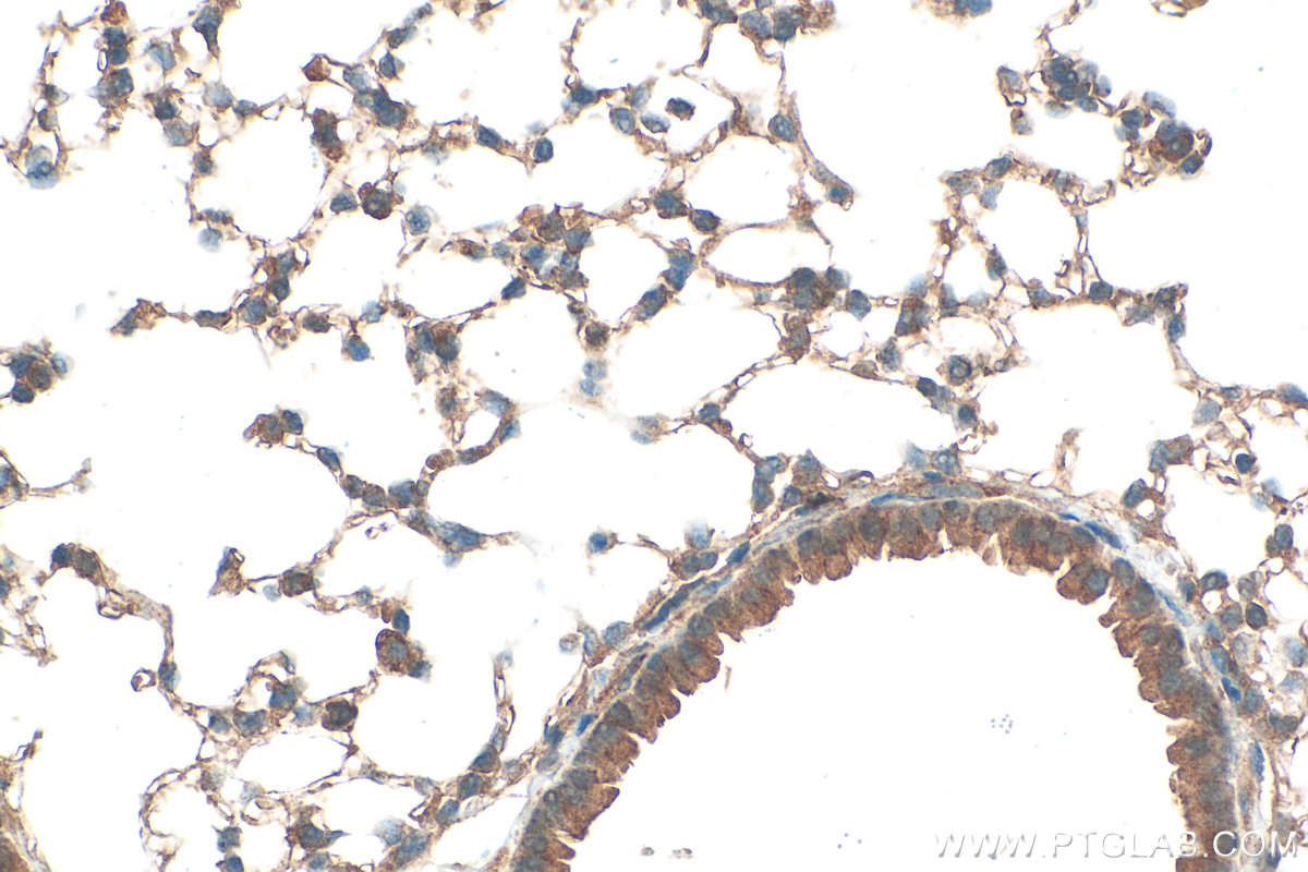 IHC staining of mouse lung using 19118-1-AP