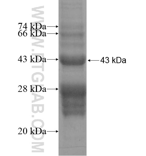 RAVER1 fusion protein Ag13292 SDS-PAGE RAVER1 fusion protein Ag13292 SDS-PAGE