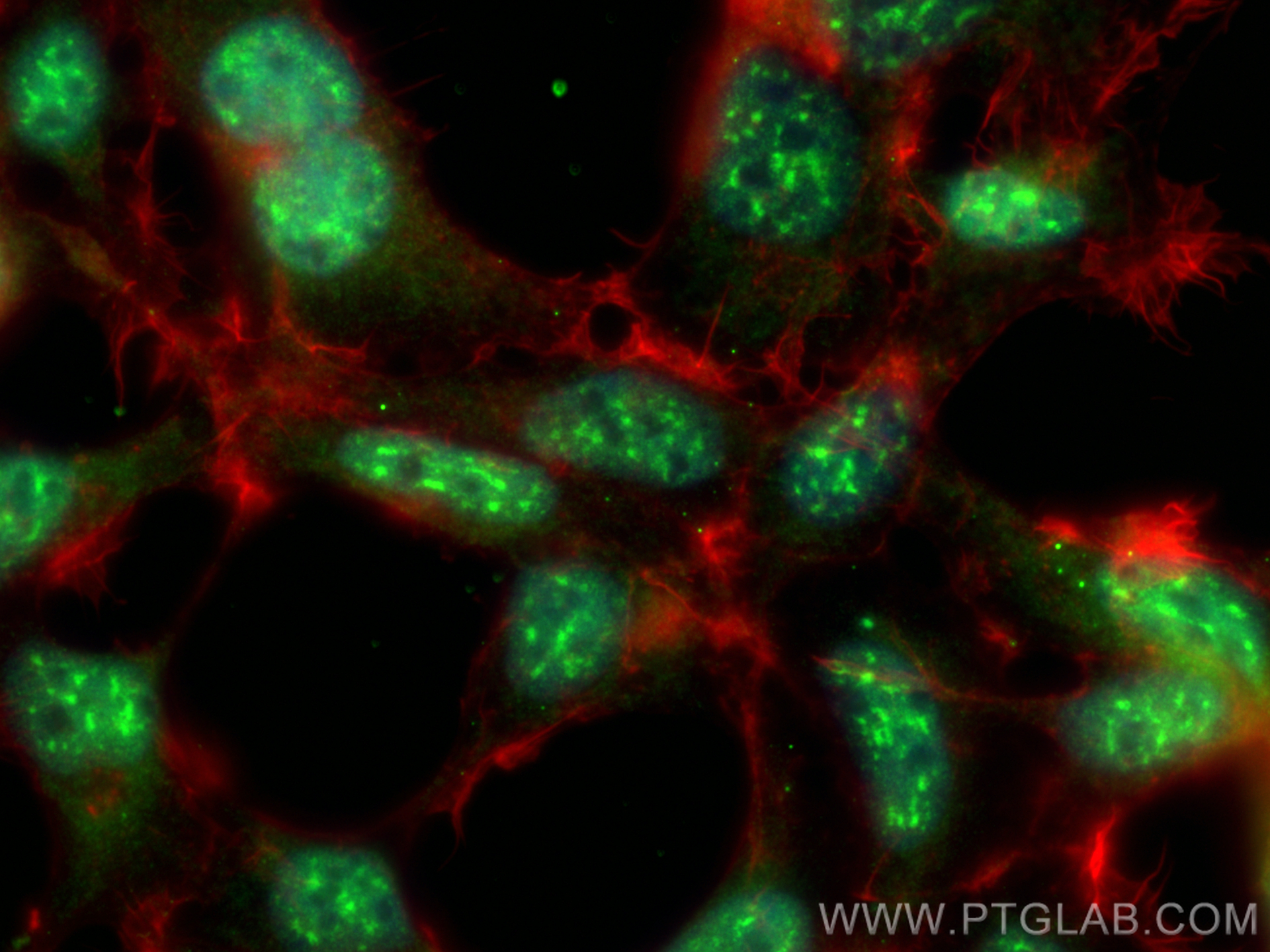 IF Staining of HEK-293 using 32025-1-AP (same clone as 32025-1-PBS)
