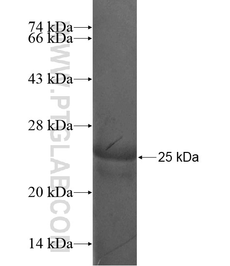 RAX fusion protein Ag19385 SDS-PAGE