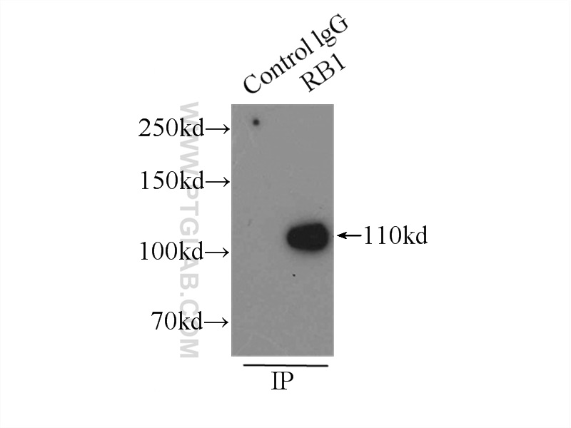 IP experiment of A431 using 10048-2-Ig