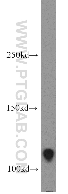 WB analysis of HT-1080 using 17218-1-AP