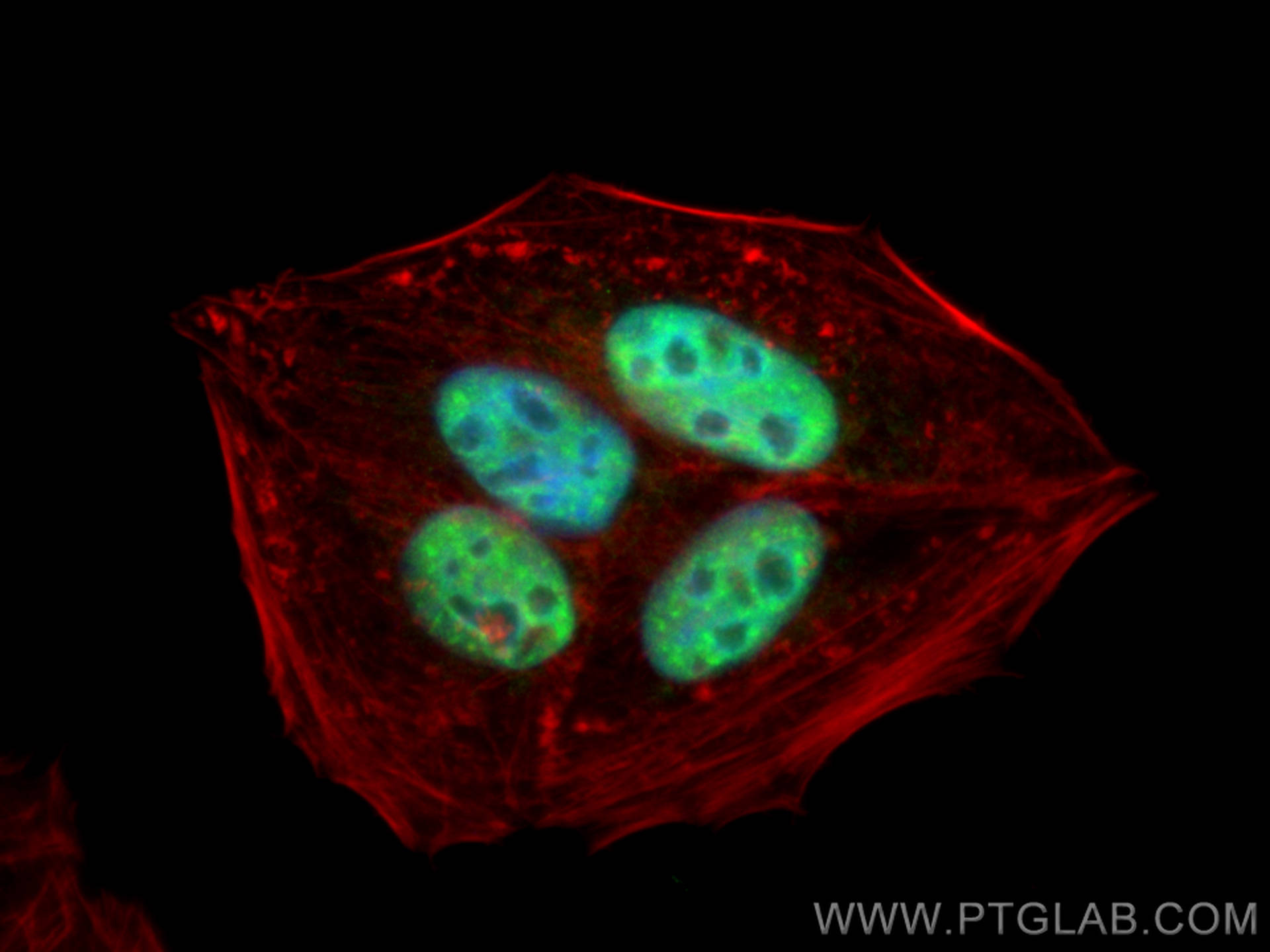 IF Staining of HepG2 using 30373-1-AP