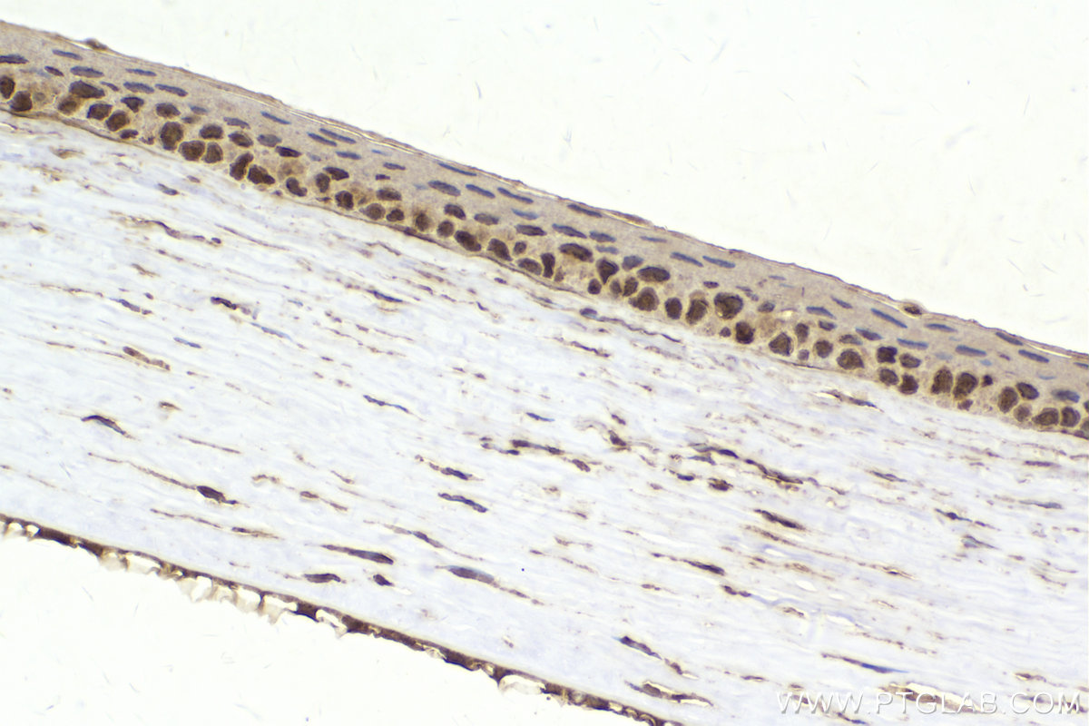 IHC staining of rat eye using 67521-1-Ig
