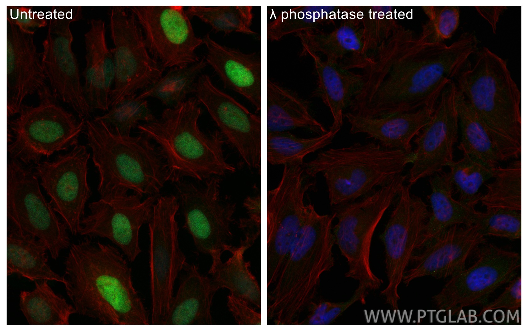 IF Staining of HeLa using 84692-1-RR