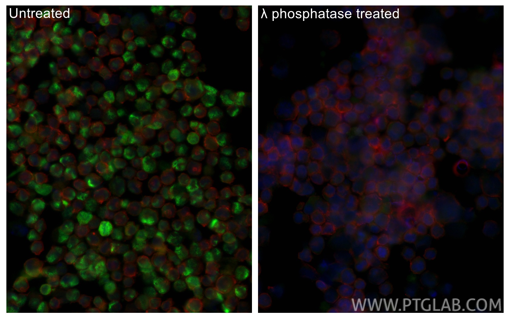 IF Staining of K-562 using 84692-1-RR