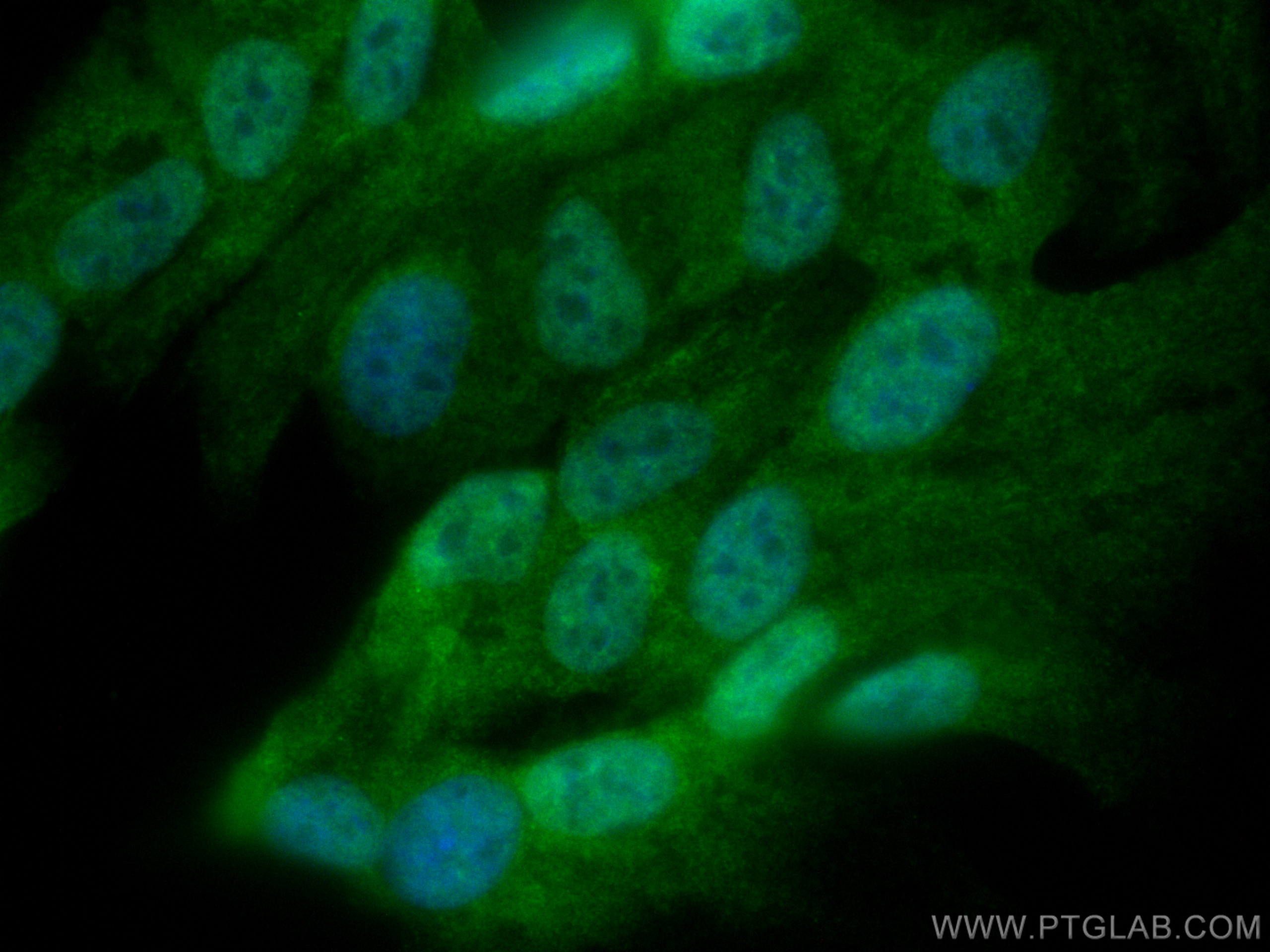 IF Staining of hTERT-RPE1 using CL488-67521