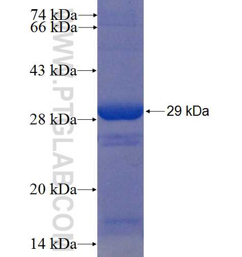 RB1 fusion protein Ag22578 SDS-PAGE