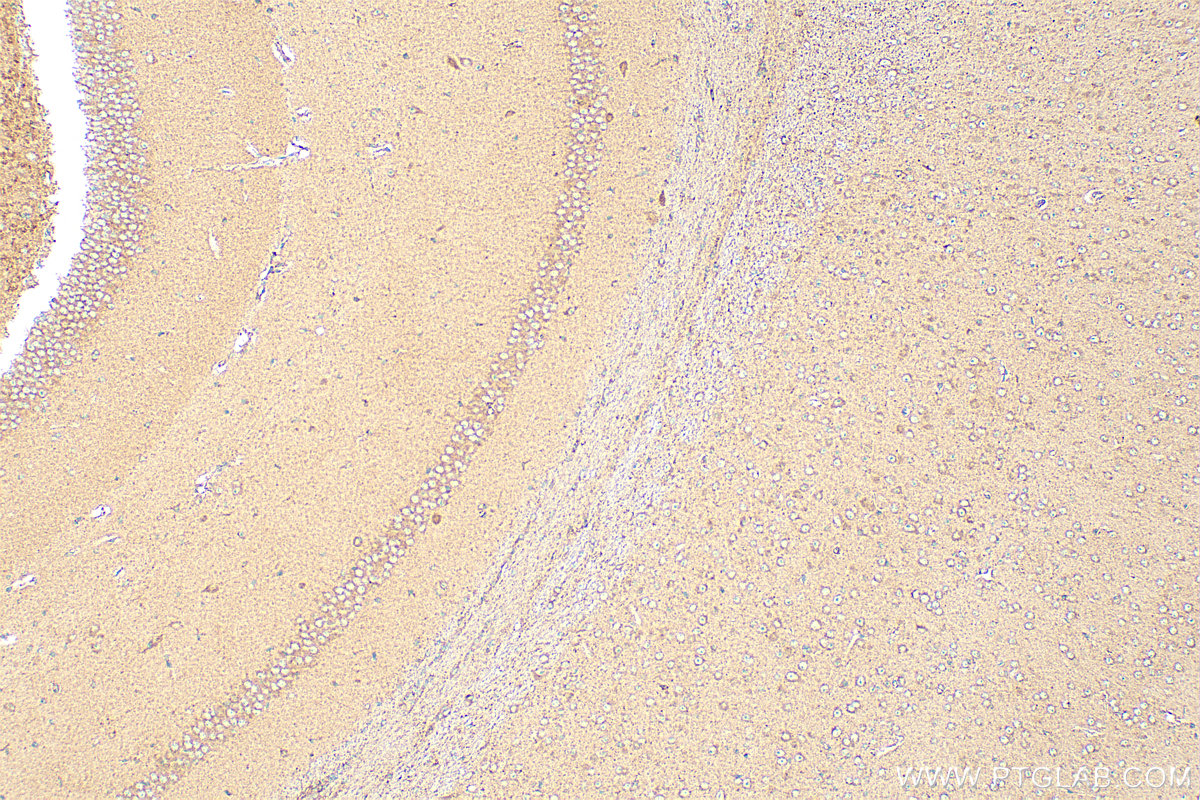 IHC staining of mouse brain using 17250-1-AP