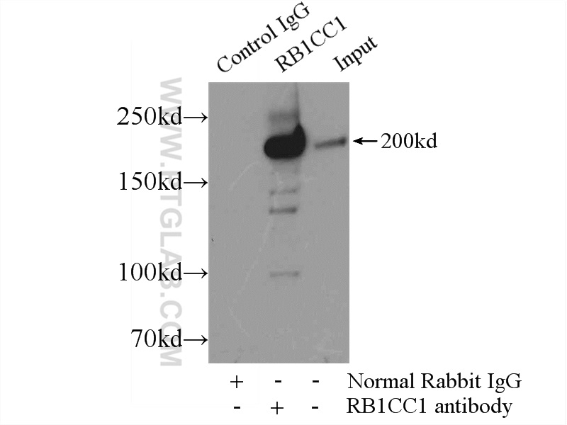 IP experiment of HEK-293 using 17250-1-AP