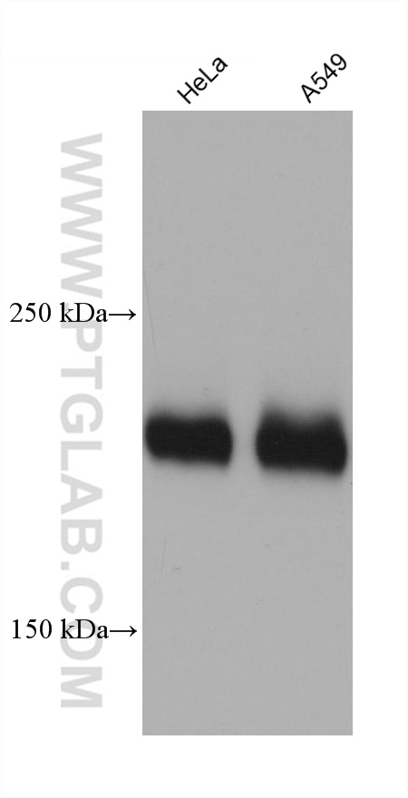 WB analysis using 68564-1-Ig