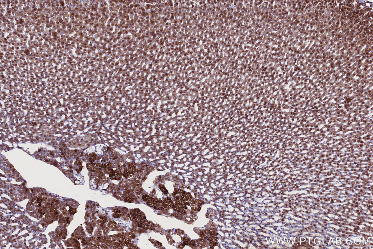 IHC staining of rat adrenal gland using 84757-3-RR IHC staining of rat adrenal gland using 84757-3-RR