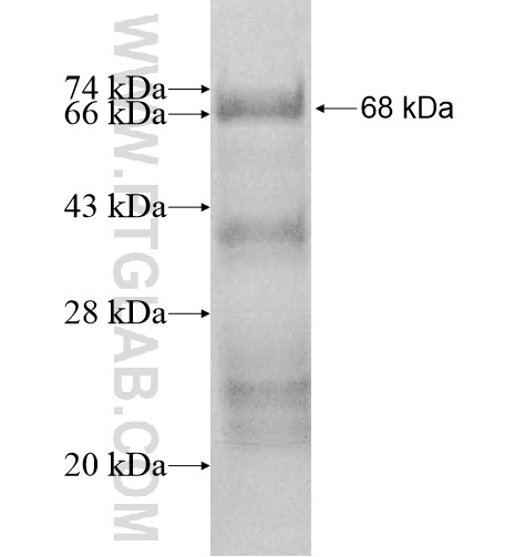RB1CC1 fusion protein Ag10528 SDS-PAGE RB1CC1 fusion protein Ag10528 SDS-PAGE