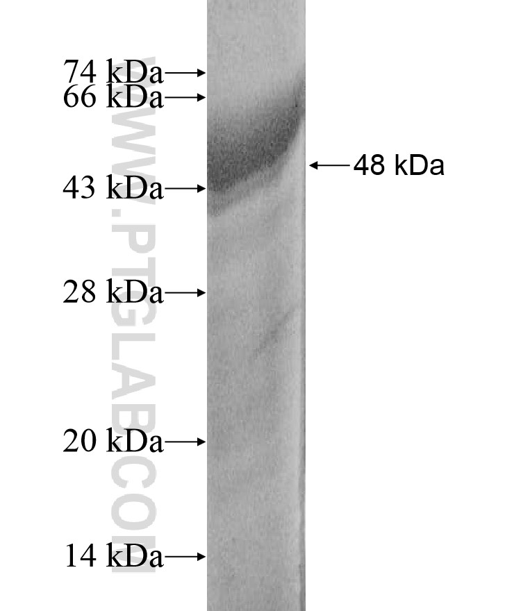 RB1CC1 fusion protein Ag17208 SDS-PAGE RB1CC1 fusion protein Ag17208 SDS-PAGE