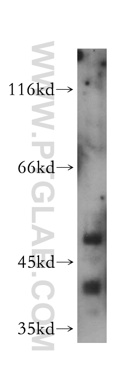 WB analysis of HeLa using 14557-1-AP