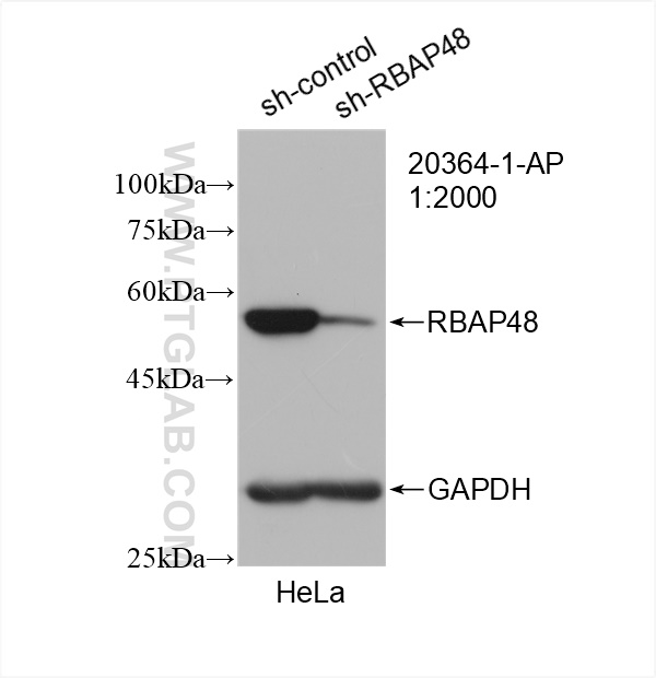 WB analysis of HeLa using 20364-1-AP