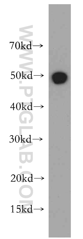 RBAP48 Polyclonal antibody