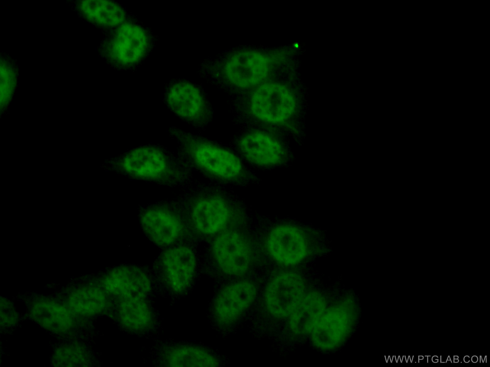 IF Staining of HepG2 using 66060-1-Ig (same clone as 66060-1-PBS)
