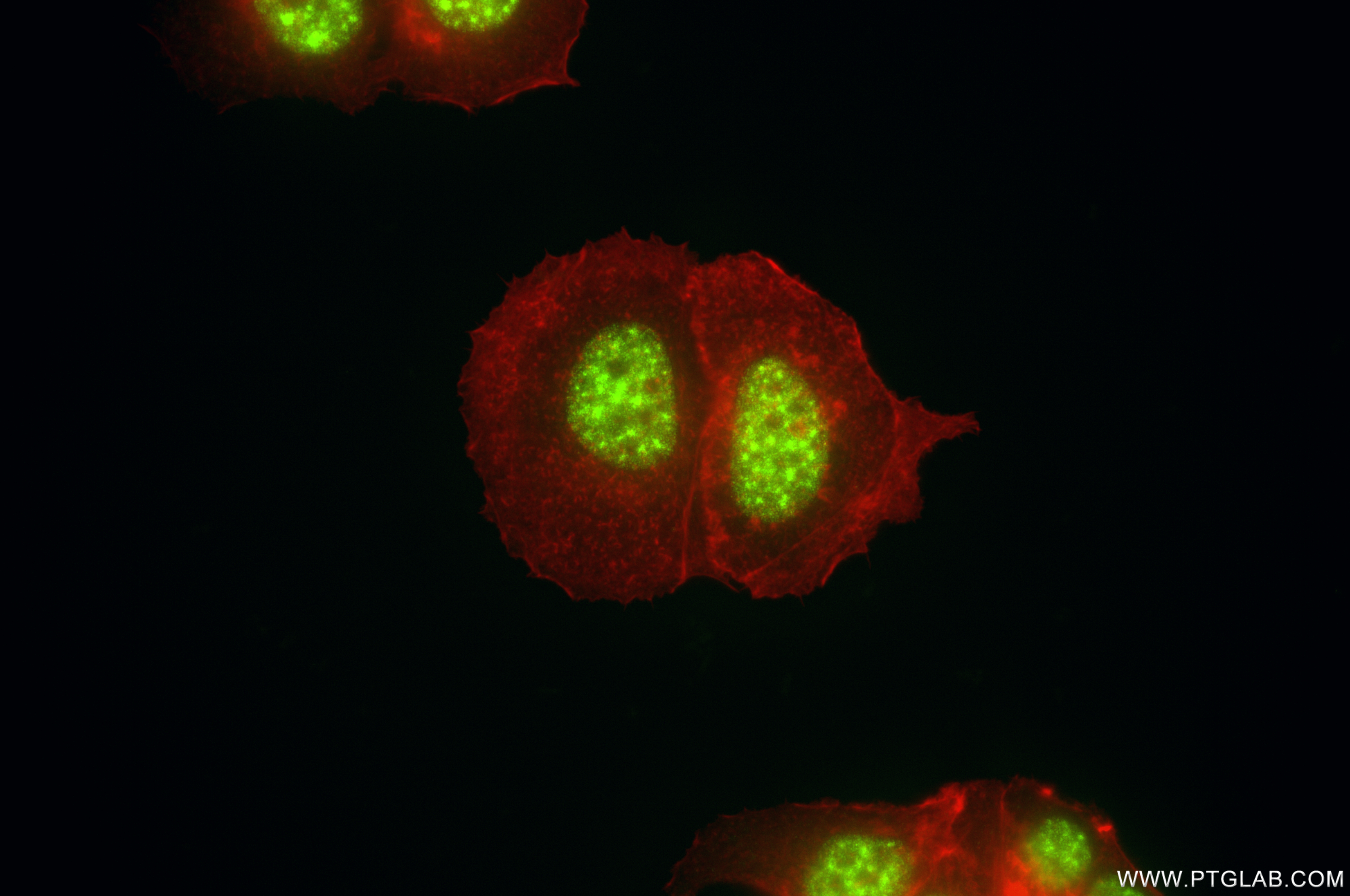 IF Staining of MCF-7 using 85884-5-RR (same clone as 85884-5-PBS)