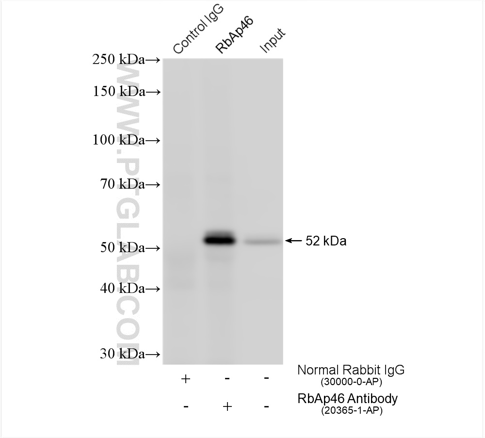 IP experiment of A431 using 20365-1-AP