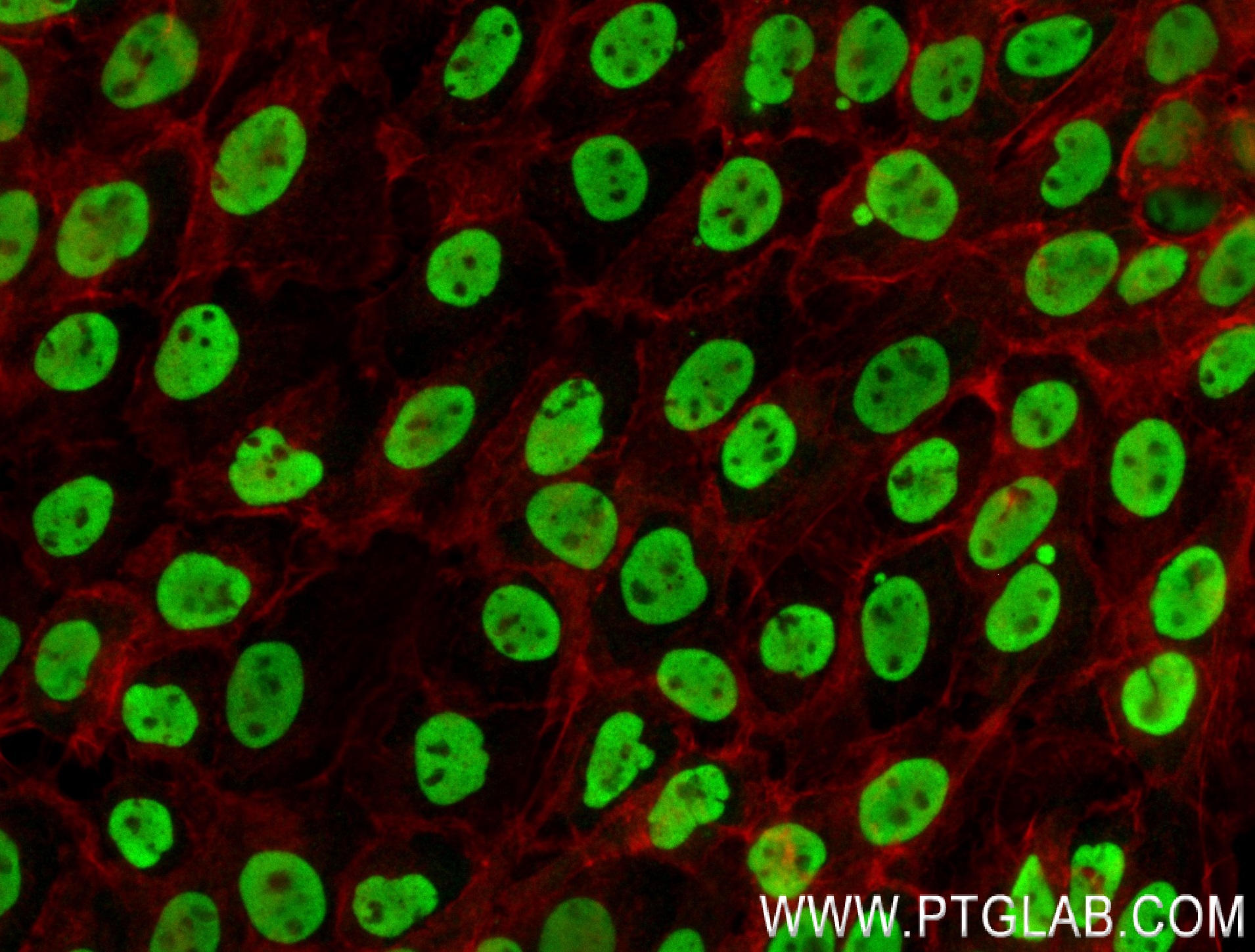IF Staining of A431 using 84330-1-RR