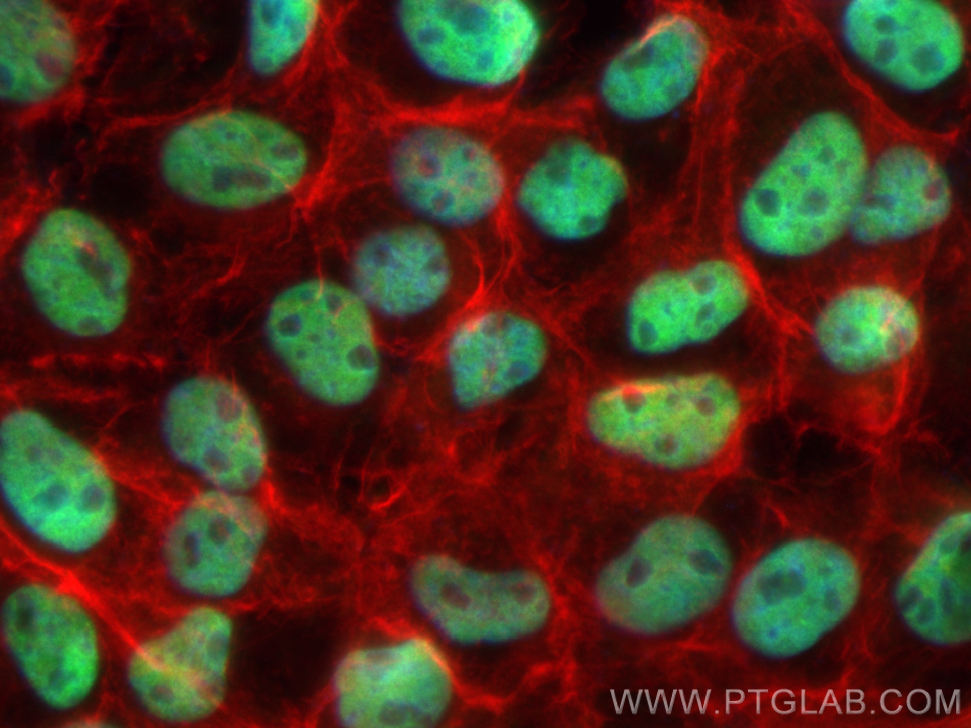 IF Staining of A431 using CL488-84330