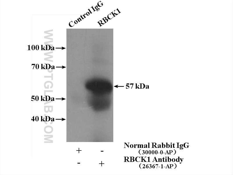 IP experiment of human placenta using 26367-1-AP