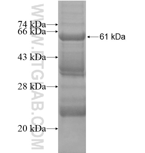 RBCK1 fusion protein Ag13554 SDS-PAGE RBCK1 fusion protein Ag13554 SDS-PAGE