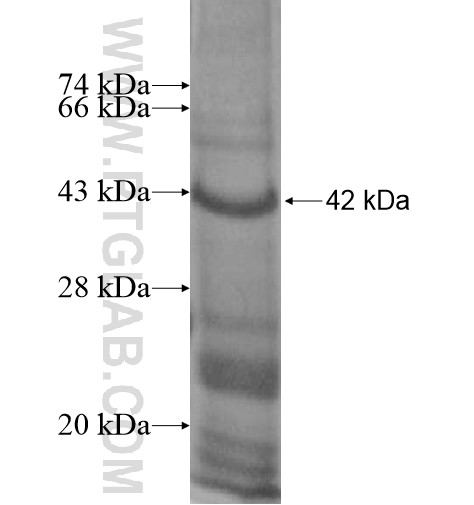 RBCK1 fusion protein Ag13598 SDS-PAGE RBCK1 fusion protein Ag13598 SDS-PAGE