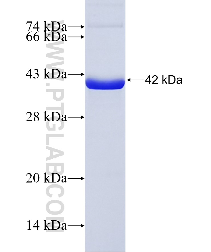 RBKS fusion protein Ag36433 SDS-PAGE RBKS fusion protein Ag36433 SDS-PAGE