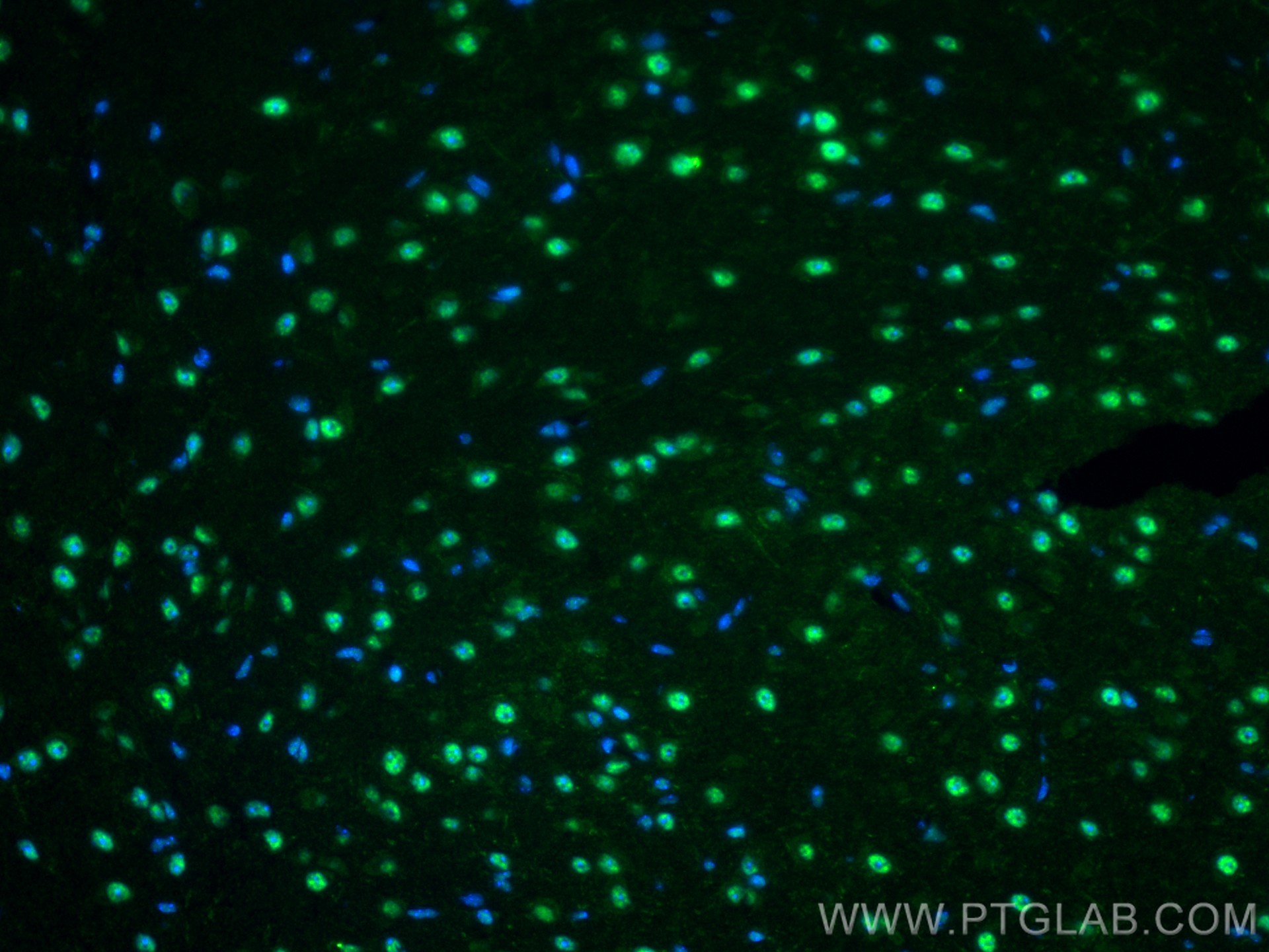 IF Staining of mouse brain using 14423-1-AP