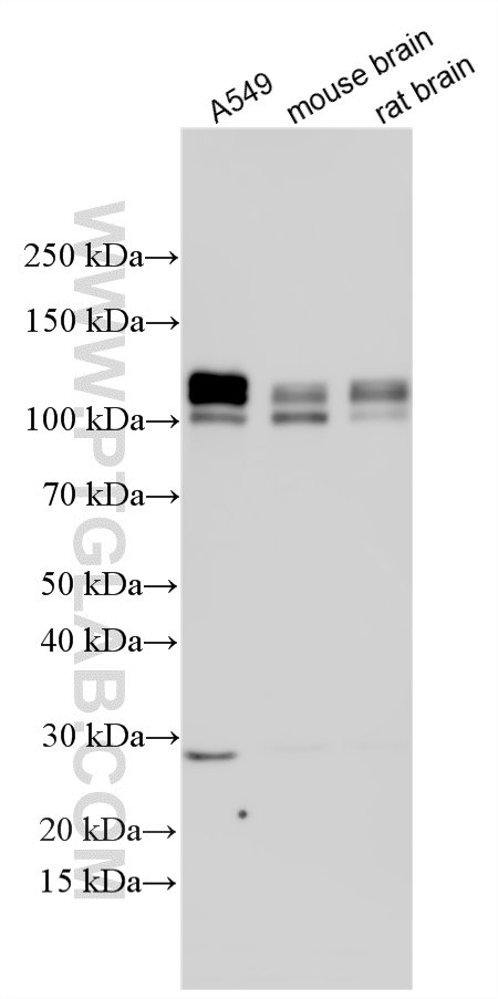 Various lysates were subjected to SDS PAGE followed by western blot with 14423-1-AP (RBM10 antibody) at dilution of 1:6000 incubated at room temperature for 1.5 hours. WB analysis using 14423-1-AP