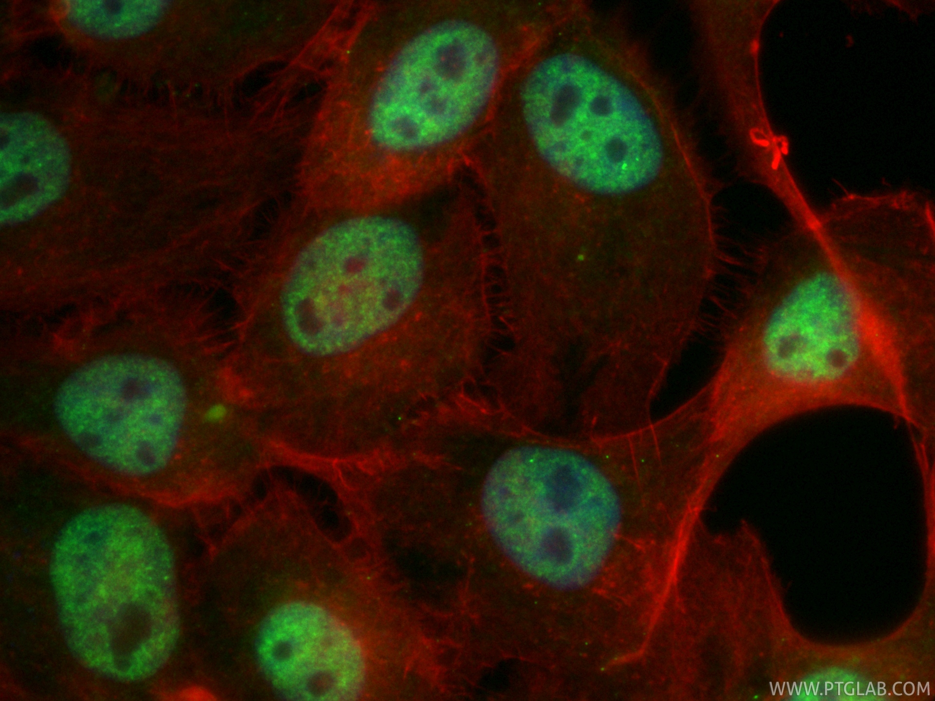 Immunofluorescent analysis of (4% PFA) fixed A431 cells using CoraLite® Plus 488 RBM10 antibody (CL488-84104-2, Clone: 241151D7 ) at dilution of 1:200, CL594-phalloidin (red). IF Staining of A431 using CL488-84104-2