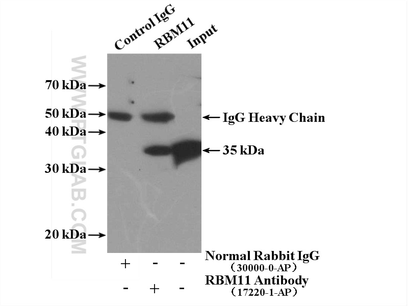 IP experiment of HEK-293 using 17220-1-AP