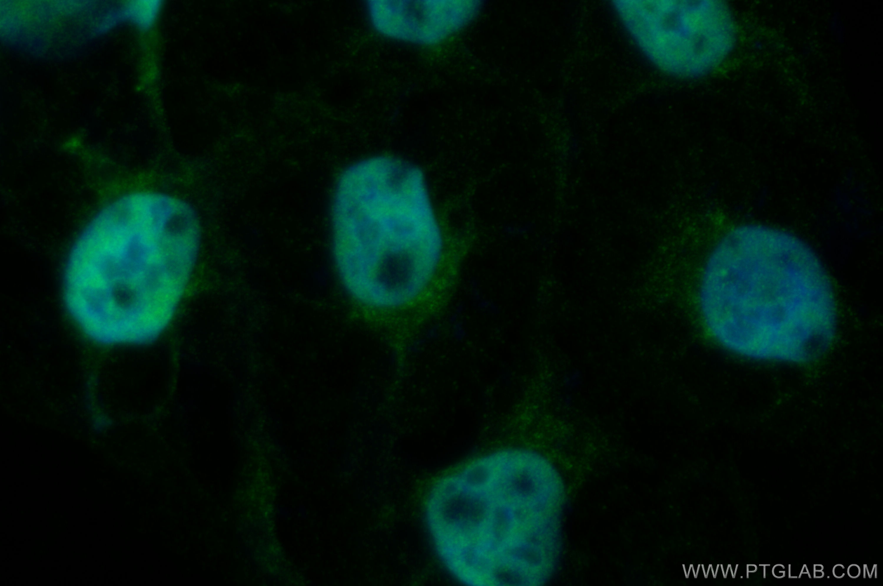 IF Staining of U2OS using 30990-1-AP