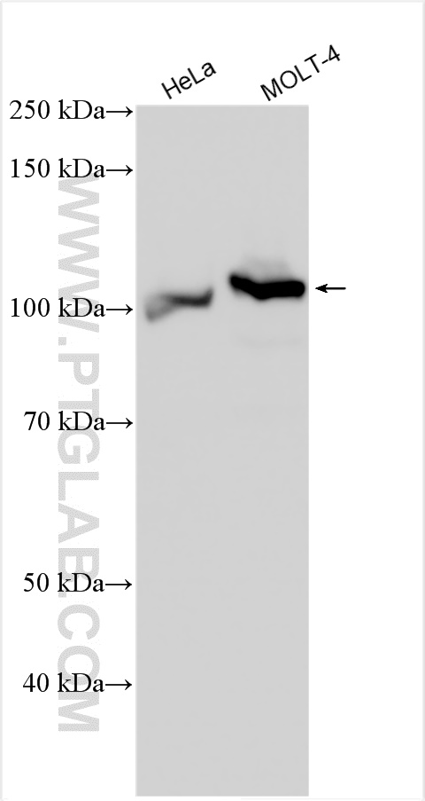 WB analysis using 30990-1-AP
