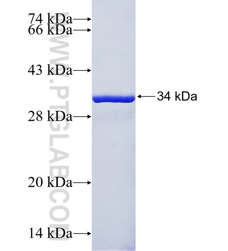 RBM12 fusion protein Ag34621 SDS-PAGE