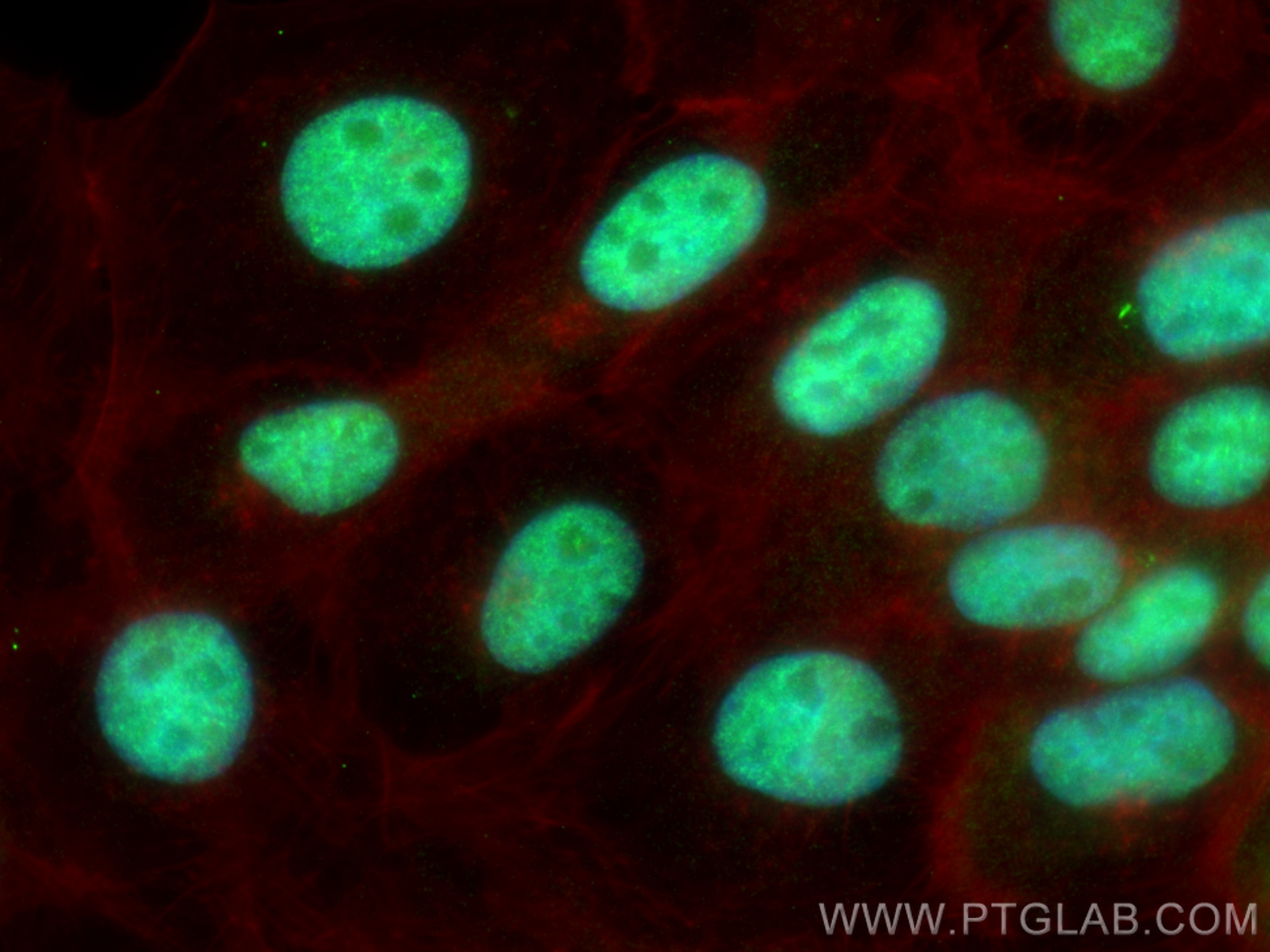 IF Staining of A431 using 17137-1-AP