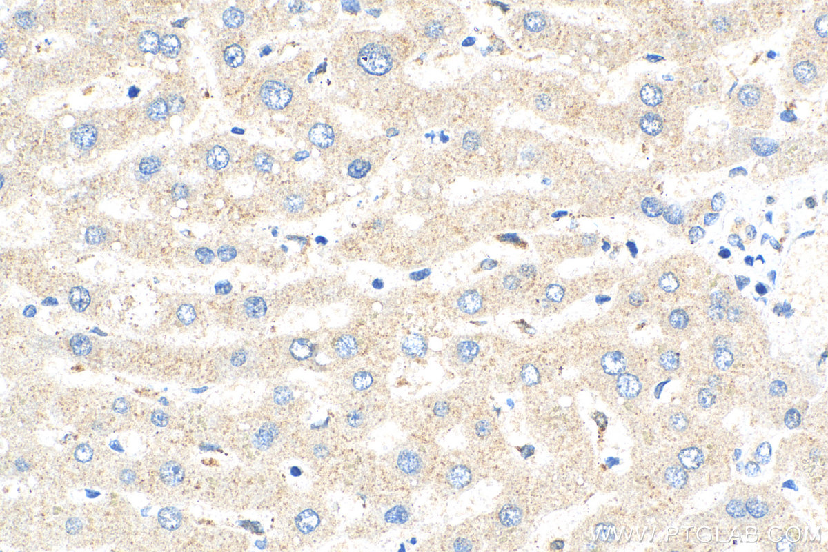 IHC staining of human liver using 17137-1-AP