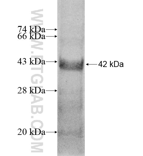 RBM12B fusion protein Ag10855 SDS-PAGE RBM12B fusion protein Ag10855 SDS-PAGE