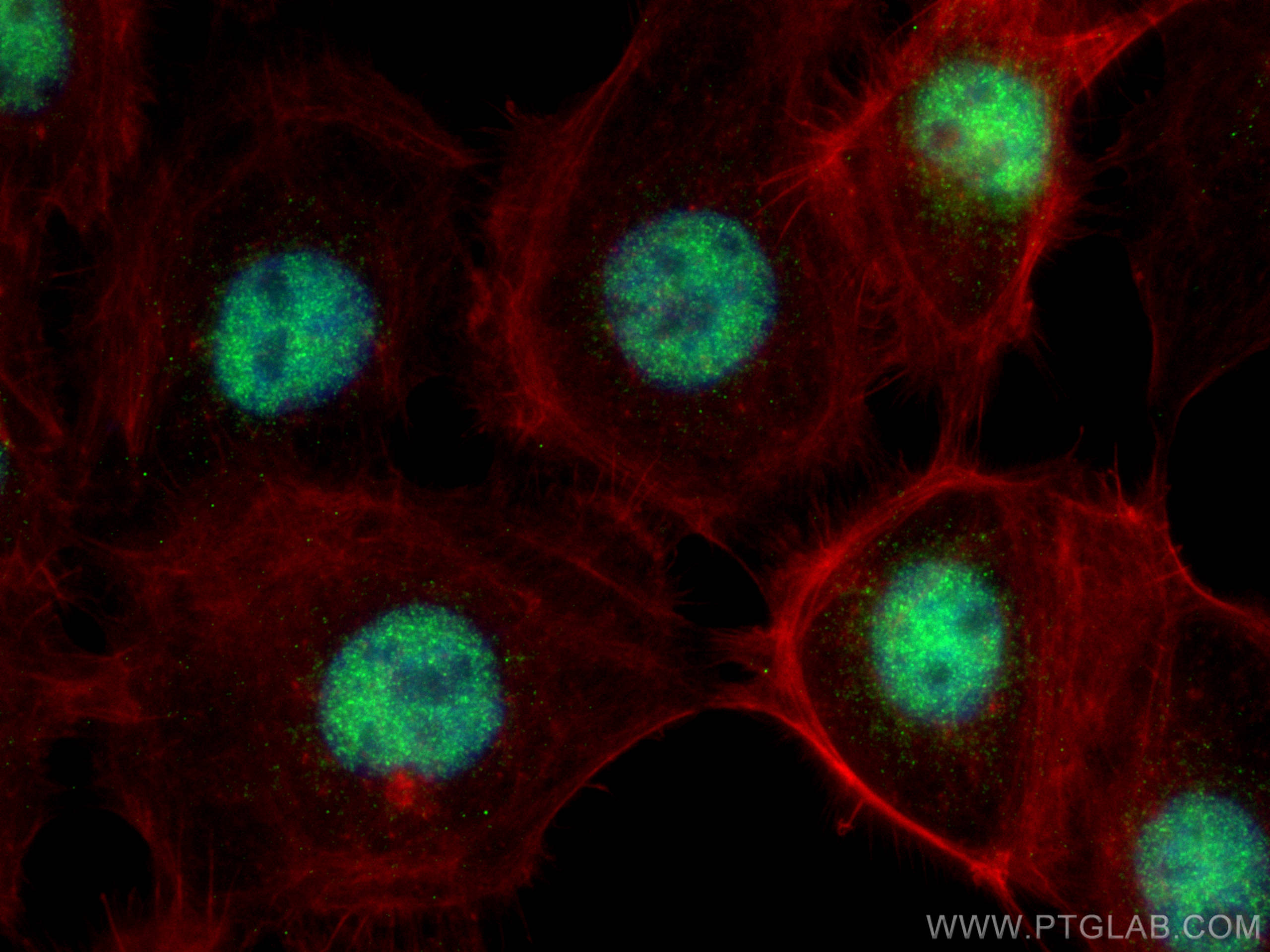 IF Staining of A431 using 10587-1-AP