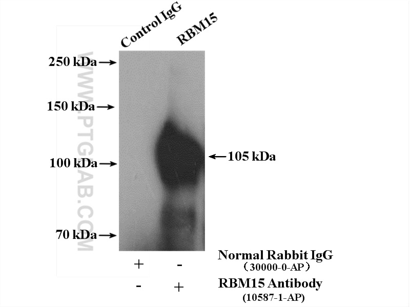 IP experiment of HEK-293 using 10587-1-AP