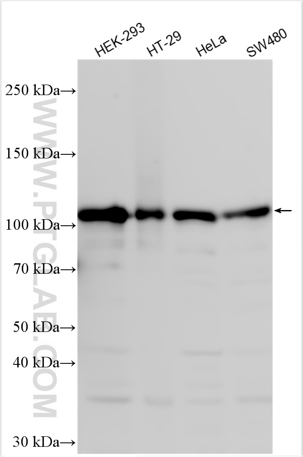 WB analysis using 10587-1-AP