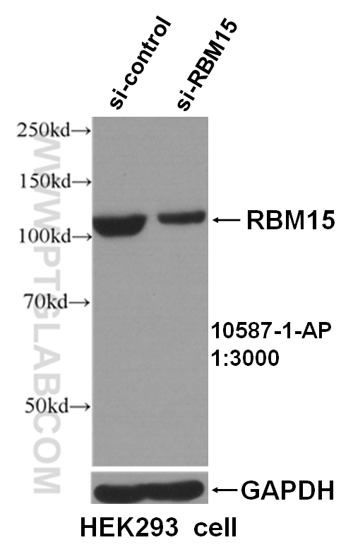 WB analysis of HEK293 cells using 10587-1-AP