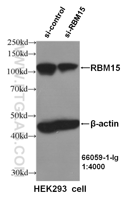 WB analysis of HEK293 cells using 66059-1-Ig