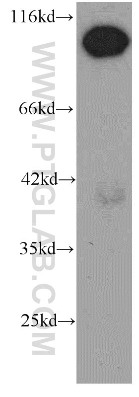 WB analysis of HeLa using 66059-1-Ig