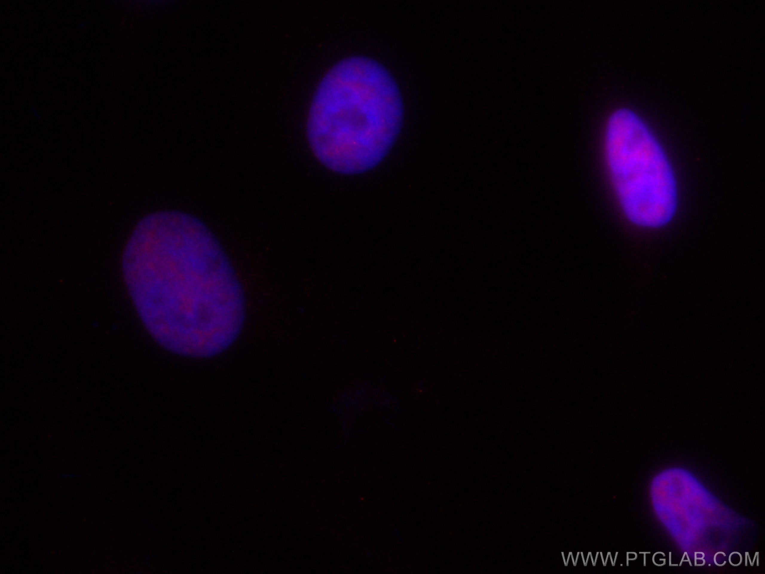 IF Staining of HeLa using CL594-66059