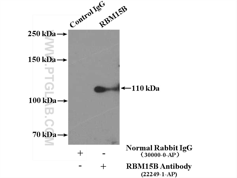 IP experiment of HeLa using 22249-1-AP